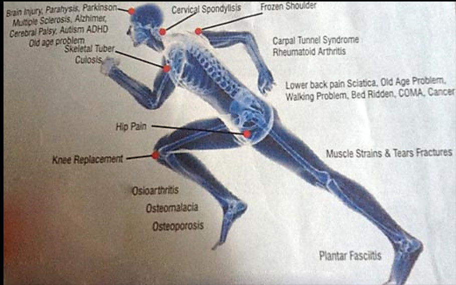Pulsed Electromagnetic Field Therapy